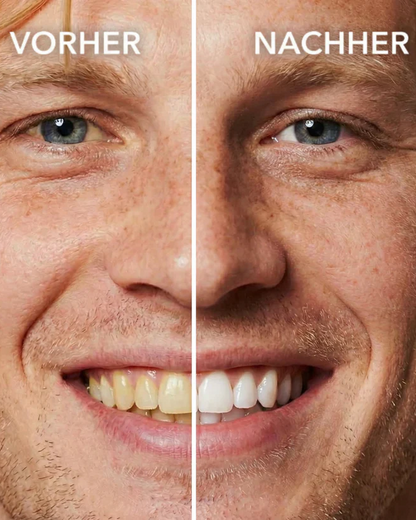 Tooth Polish - Instant Clean Smile