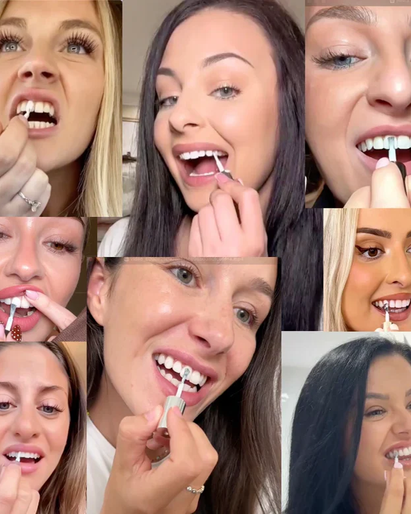 Tooth Polish - Instant Clean Smile