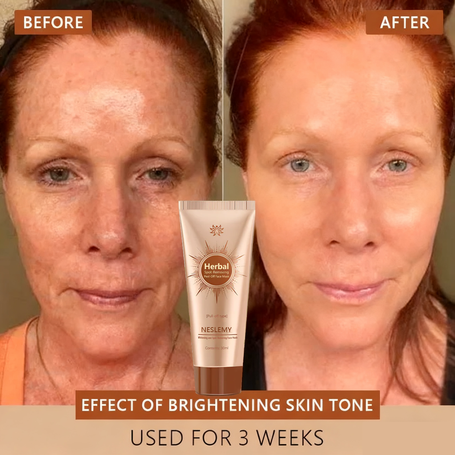 Blemish Skin Whitening Lightening Spot Mask Freckle👩‍⚕️