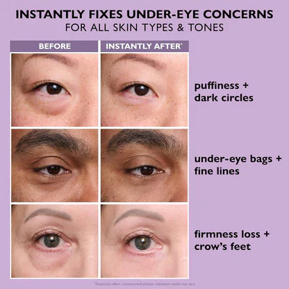 🔥 Last 3 Hours 50% OFF ✨ BUY 2 GET 1 FREE🔥Eye Bag Eraser — Instantly Refreshes, Firms & Smooths for a Youthful Look That Lasts 8 Hours