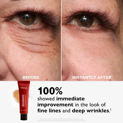 🔥 Last 3 Hours 50% OFF ✨ BUY 2 GET 1 FREE🔥Eye Bag Eraser — Instantly Refreshes, Firms & Smooths for a Youthful Look That Lasts 8 Hours