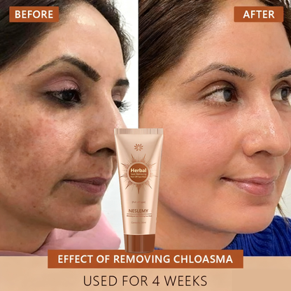 Blemish Skin Whitening Lightening Spot Mask Freckle👩‍⚕️
