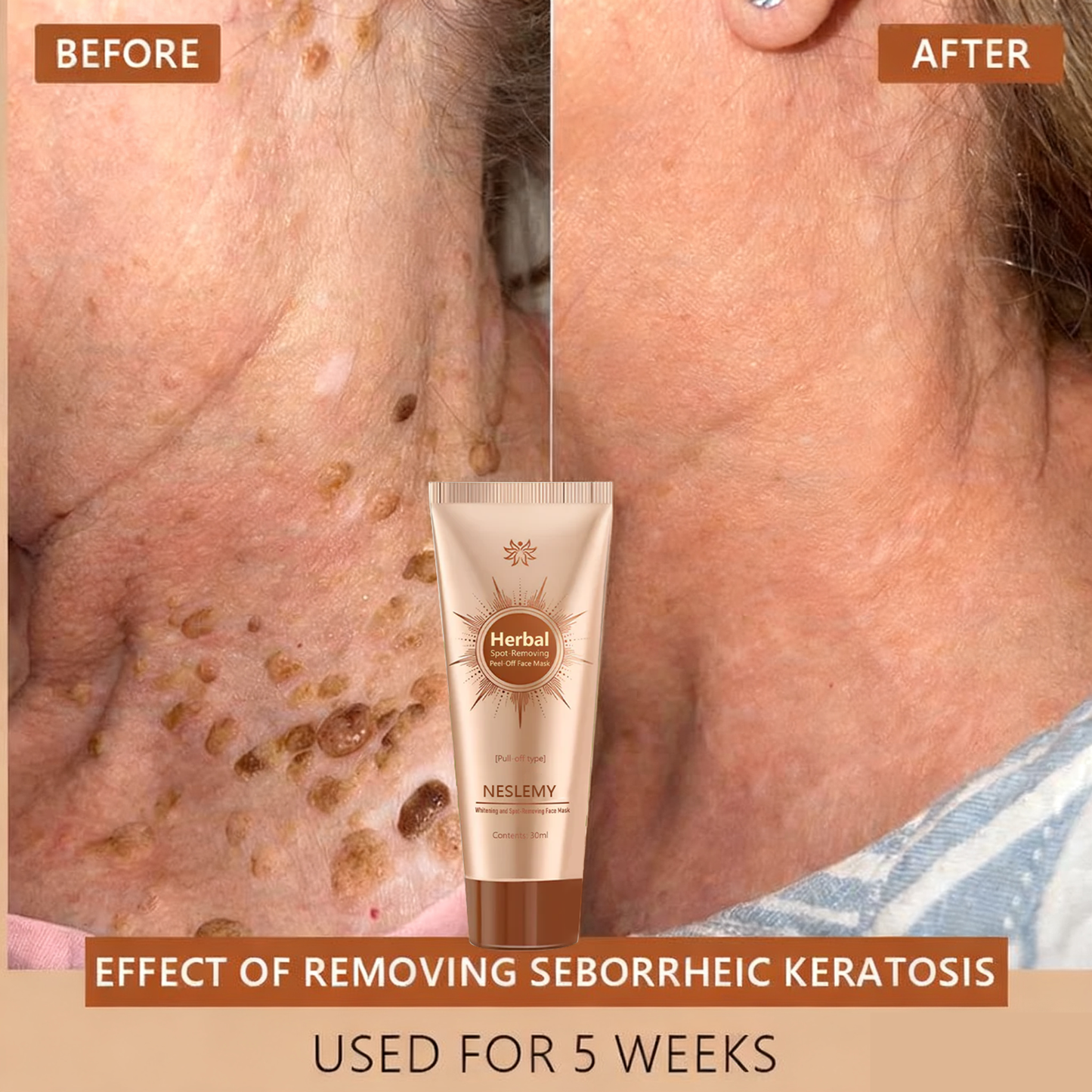 Blemish Skin Whitening Lightening Spot Mask Freckle👩‍⚕️