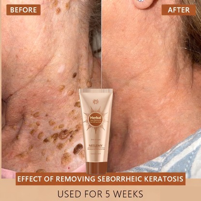 Blemish Skin Whitening Lightening Spot Mask Freckle👩‍⚕️