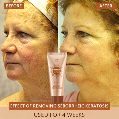 Blemish Skin Whitening Lightening Spot Mask Freckle👩‍⚕️