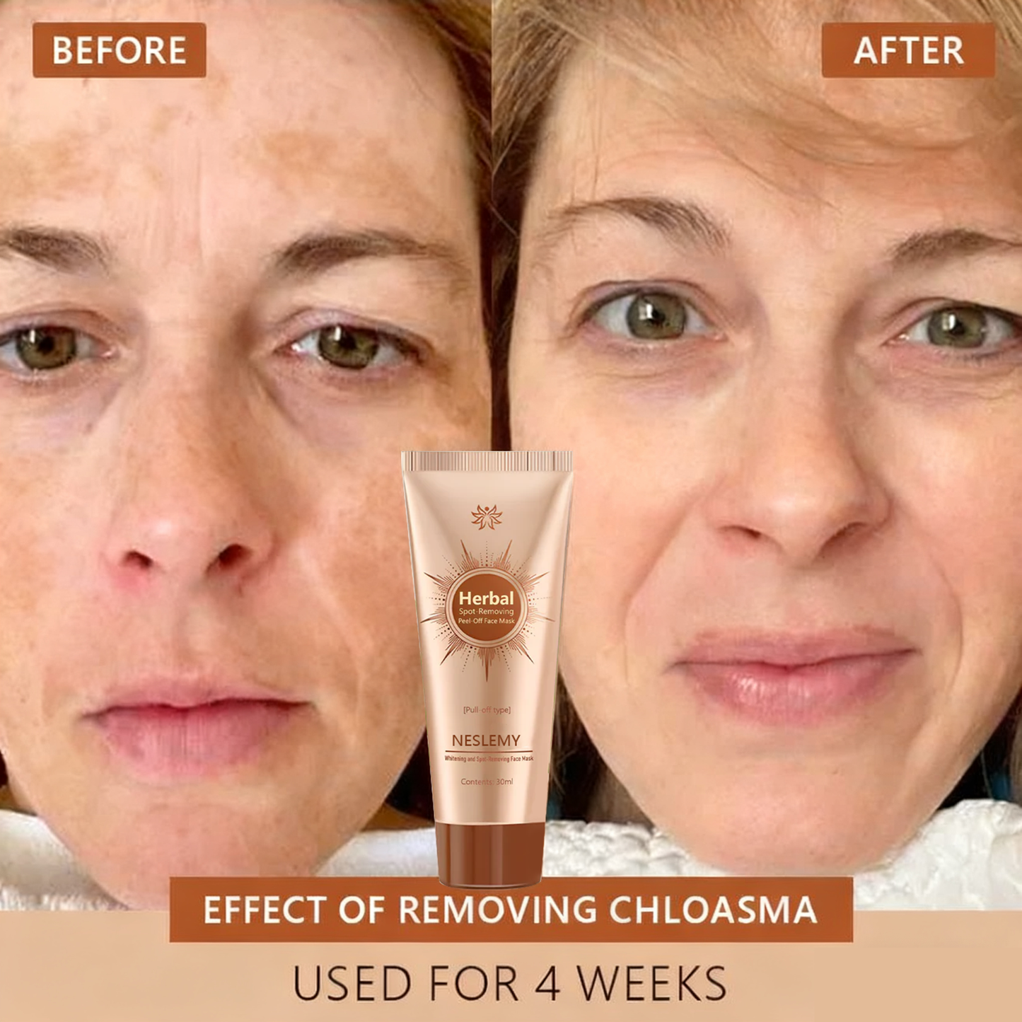 Blemish Skin Whitening Lightening Spot Mask Freckle👩‍⚕️
